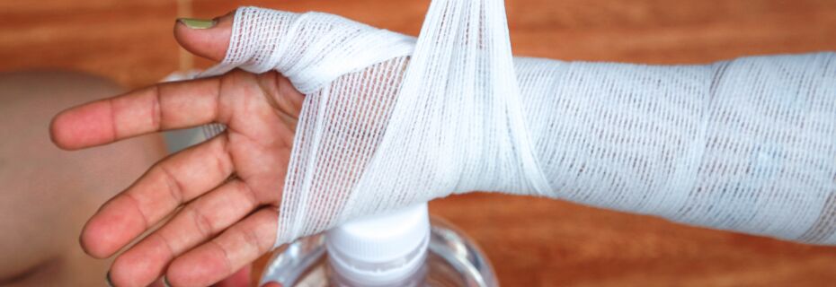 burn injuries